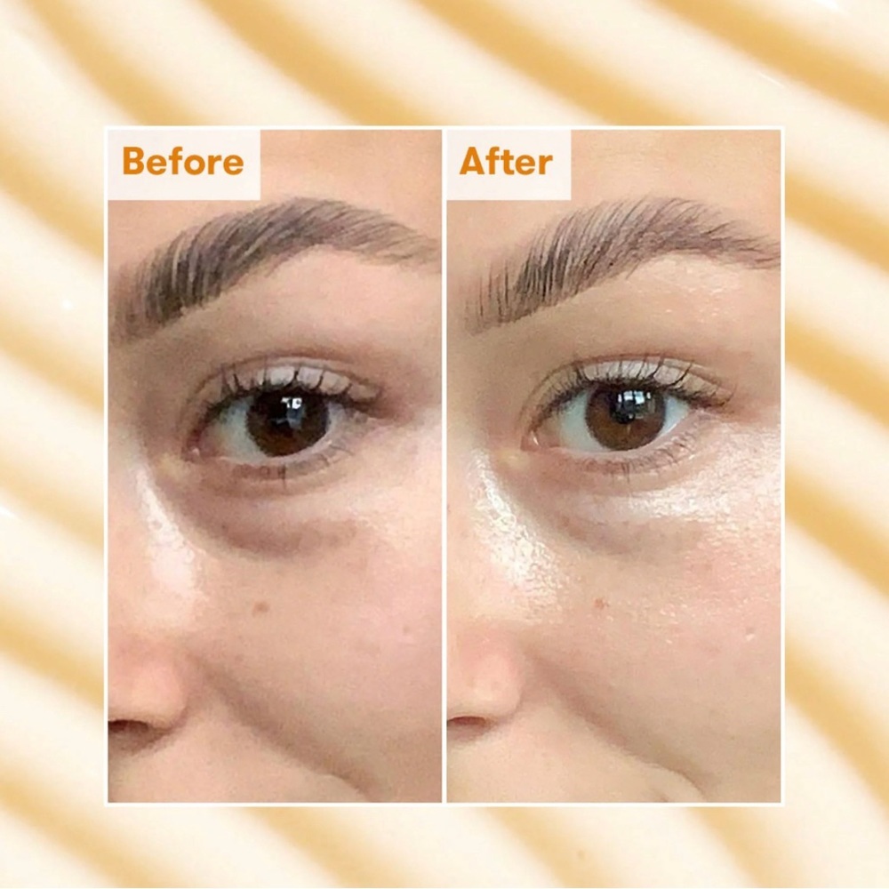REN Clean Skincare Radiance Brightening Dark Circle Eye Cream - Picture 3 of 3